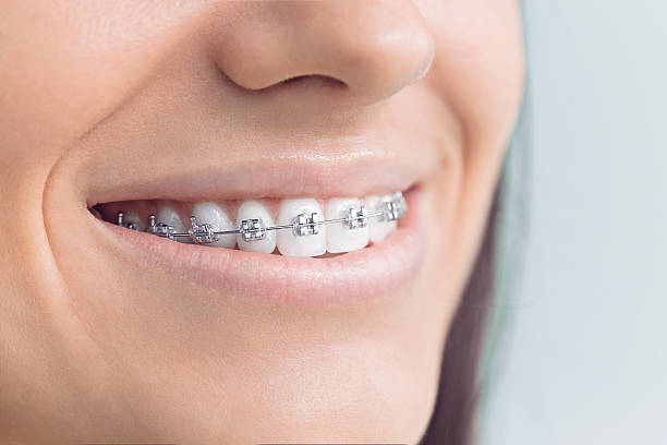 Best Dental Fillings (Composite and Amalgam)  in Park City, IL